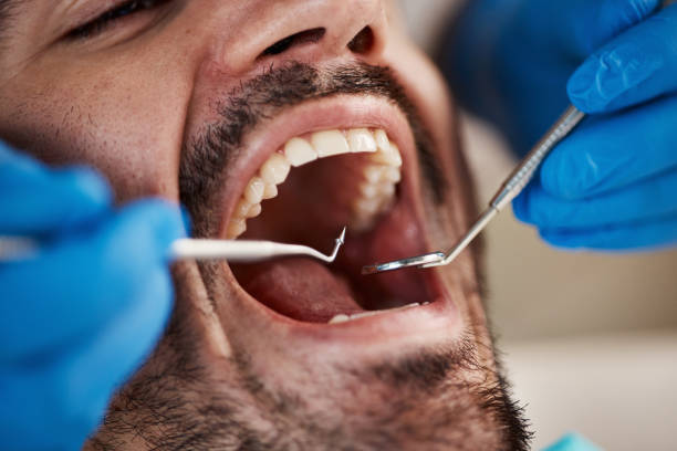 Best Cosmetic Emergency Dentistry in Hamton, IL