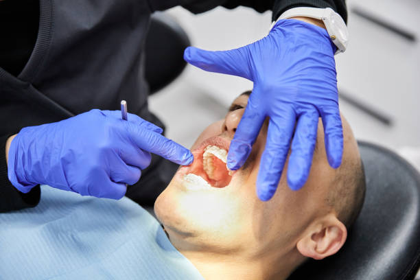 Best Emergency Root Canal Treatment in Hamton, IL