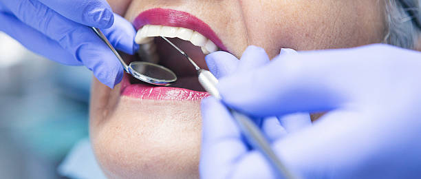 Best Emergency Treatment for Dental Infections or Abscesses in Hamton, IL